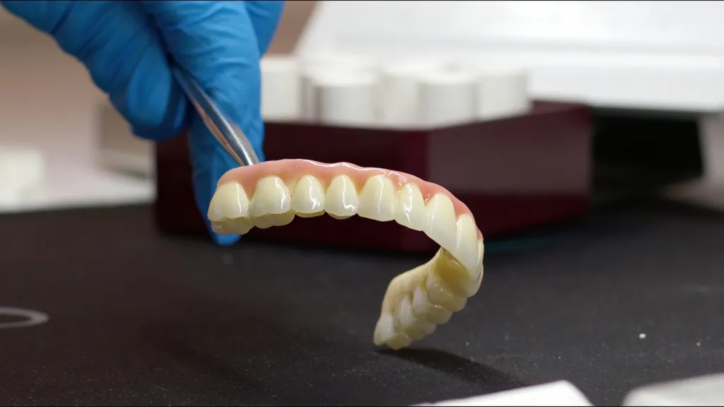 Full Arch Implants - Avira Dental